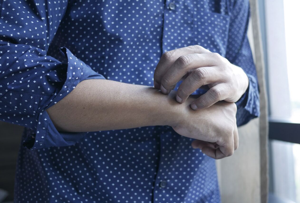秋天病乾癢抓不停 狂擦乳液也沒用？醫揭保溼「最重要時間點」